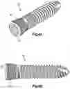 Fig. 06 - Intervertebral implants, systems, and methods of use