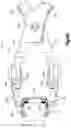Fig. 11 - Intervertebral implants, systems, and methods of use