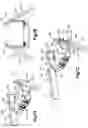 Fig. 12 - Intervertebral implants, systems, and methods of use