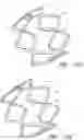 Fig. 17 - DEFORMABLE LUMEN SUPPORT DEVICES AND METHODS OF USE