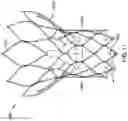 Fig. 12 - Projecting member with barb for cardiovascular devices