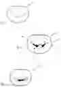 Fig. 03 - Prosthetic cardiac valve devices, systems, and methods