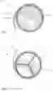 Fig. 05 - Prosthetic cardiac valve devices, systems, and methods