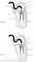 Fig. 14 - Prosthetic cardiac valve devices, systems, and methods