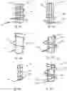 Fig. 17 - Prosthetic cardiac valve devices, systems, and methods