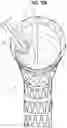 Fig. 13 - Apparatuses to facilitate prosthesis placement