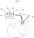 Fig. 08 - Obesity treatment