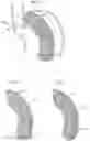 Fig. 17 - Obesity treatment