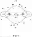 Fig. 05 - Abdominal sacral waist support belt