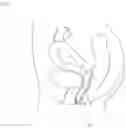 Fig. 02 - EASILY INSERTED MENSTRUAL CUP