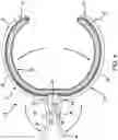 Fig. 05 - ICE CLAMP