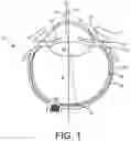 Fig. 02 - Expandable drug delivery devices and methods of use