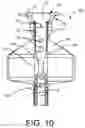Fig. 09 - Expandable drug delivery devices and methods of use