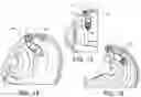Fig. 13 - Expandable drug delivery devices and methods of use