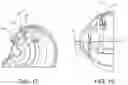 Fig. 14 - Expandable drug delivery devices and methods of use