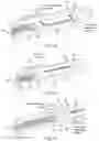 Fig. 09 - Devices and methods for cutting lenticular tissue