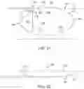 Fig. 14 - Devices and methods for cutting lenticular tissue