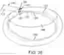 Fig. 17 - Devices and methods for cutting lenticular tissue