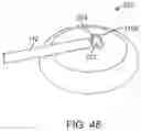 Fig. 25 - Devices and methods for cutting lenticular tissue