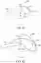 Fig. 26 - Devices and methods for cutting lenticular tissue