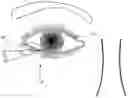 Fig. 01 - Single operator device for delivering an ocular implant