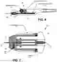Fig. 05 - Single operator device for delivering an ocular implant