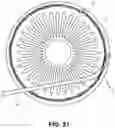 Fig. 12 - Single operator device for delivering an ocular implant