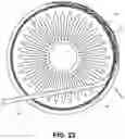 Fig. 13 - Single operator device for delivering an ocular implant