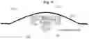 Fig. 07 - Expandable compression bandage for hemostasis