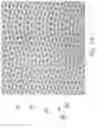 Fig. 16 - Disposable absorbent article