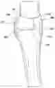 Fig. 01 - Easy change protective underwear