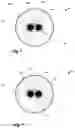 Fig. 04 - Personal hygiene device for detecting a fluid