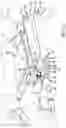 Fig. 12 - Surgical frame having translating lower beam and moveable linkage or surgical equipment attached thereto and method for use thereof