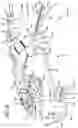 Fig. 29 - Surgical frame having translating lower beam and moveable linkage or surgical equipment attached thereto and method for use thereof