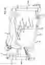Fig. 43 - Surgical frame having translating lower beam and moveable linkage or surgical equipment attached thereto and method for use thereof