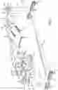 Fig. 02 - Surgical frame having translating lower beam and moveable linkage or surgical equipment attached thereto and method for use thereof