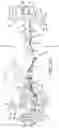 Fig. 31 - Surgical frame having translating lower beam and moveable linkage or surgical equipment attached thereto and method for use thereof