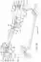 Fig. 72 - Reconfigurable surgical frame and method for use