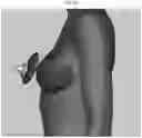 Fig. 09 - BREASTFEEDING DEVICE