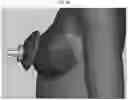Fig. 10 - BREASTFEEDING DEVICE