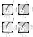 Fig. 26 - SYSTEMS, DEVICES, AND METHODS FOR PERFORMING MEDICAL PROCEDURES IN THE INTESTINE