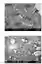 Fig. 03 - Composition for intracanal medication