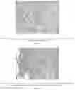 Fig. 12 - Methods for treating lung disorders
