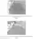 Fig. 13 - Methods for treating lung disorders