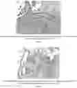 Fig. 14 - Methods for treating lung disorders