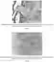 Fig. 15 - Methods for treating lung disorders