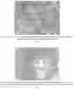 Fig. 16 - Methods for treating lung disorders