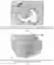 Fig. 17 - Methods for treating lung disorders