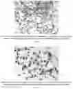 Fig. 20 - Methods for treating lung disorders