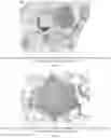 Fig. 24 - Methods for treating lung disorders